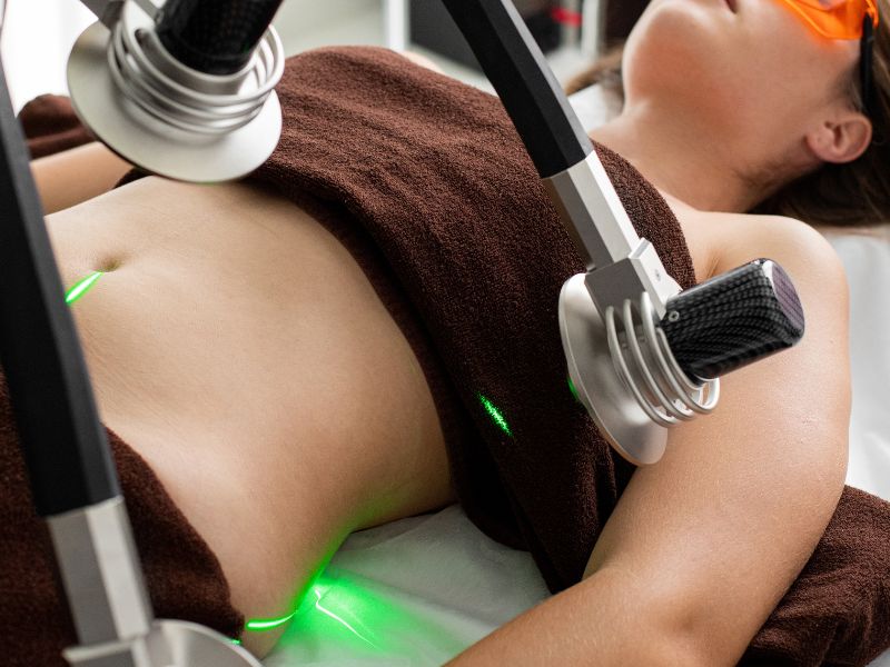 cryolipolyse. c'est quoi ?